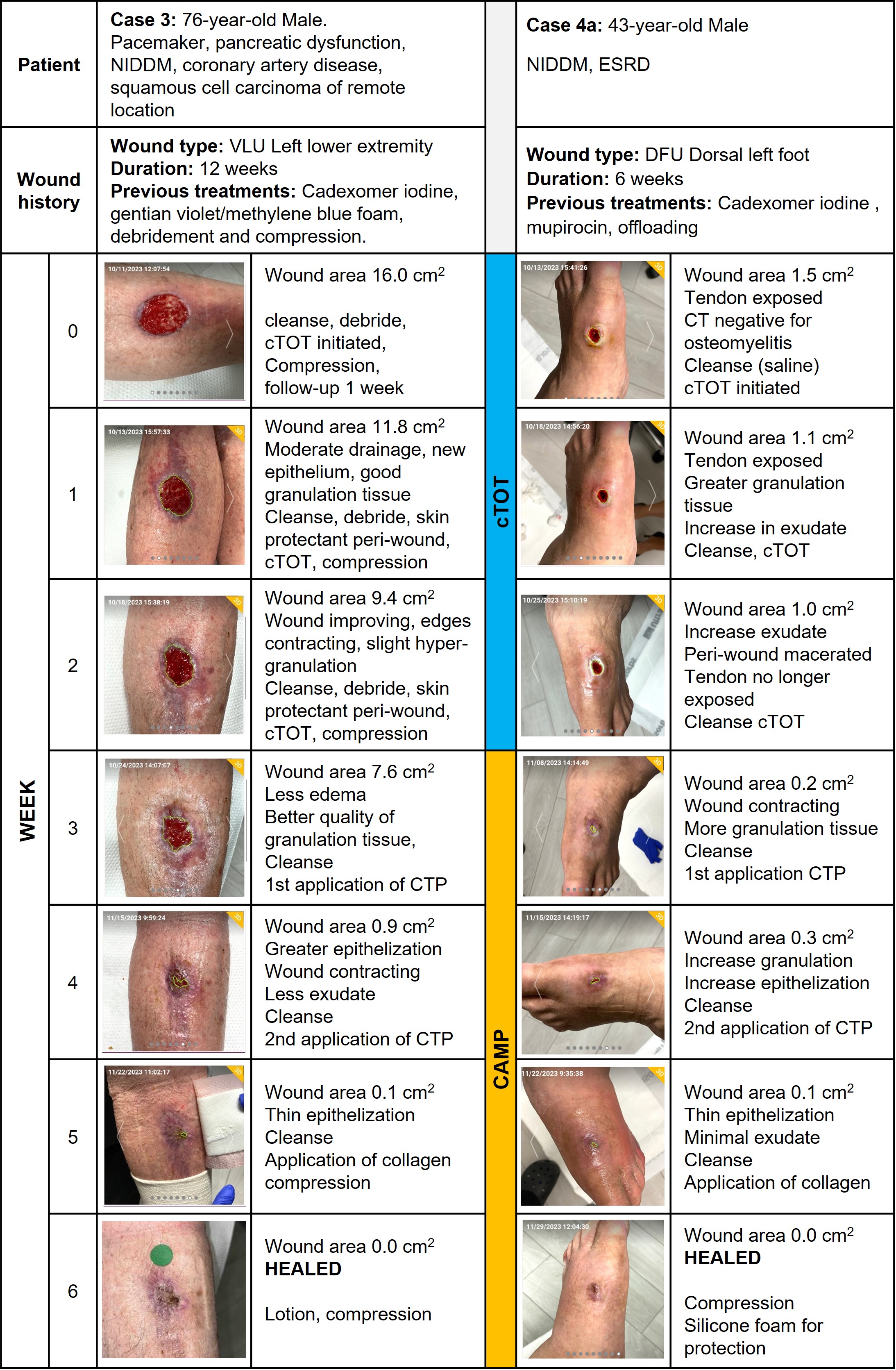 Use of Continuous Topical Oxygen Therapy in Combination to